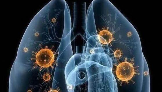 如何區(qū)分感冒、流感 和新型冠狀病毒 感染的肺